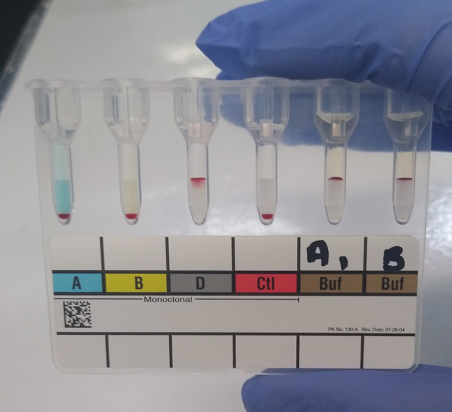 Gel microcolumn agglutination