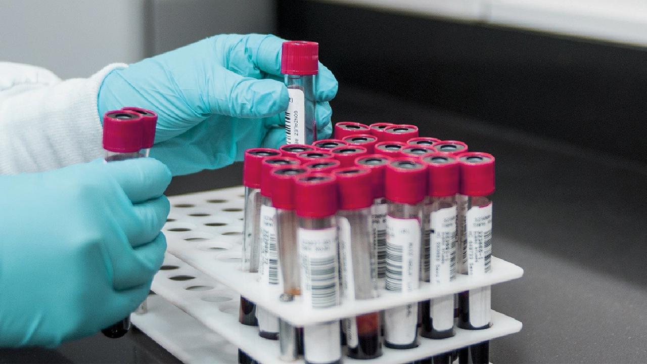 Obtaining blood serum