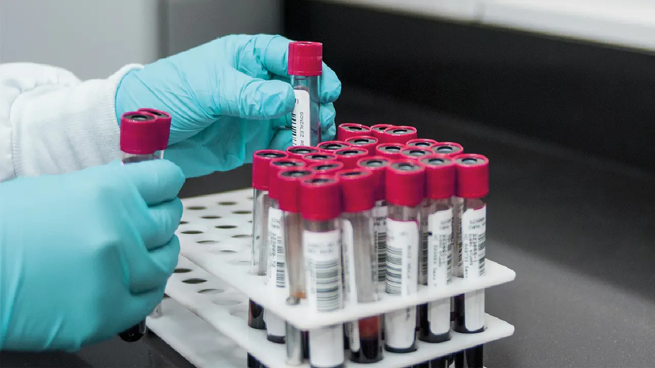 Obtaining blood serum