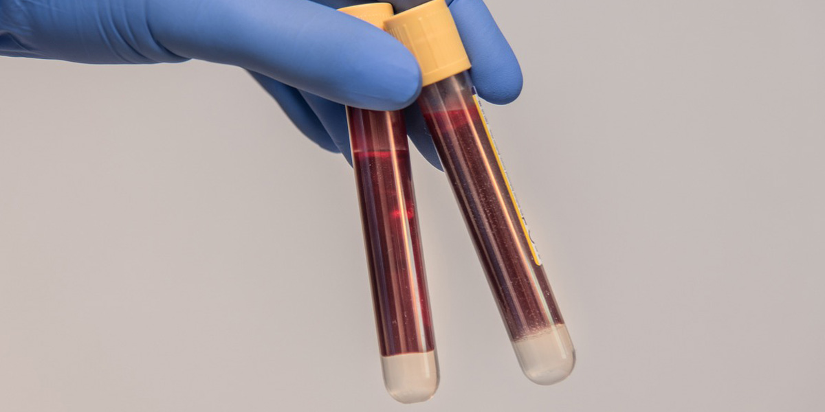 CT with separator gel