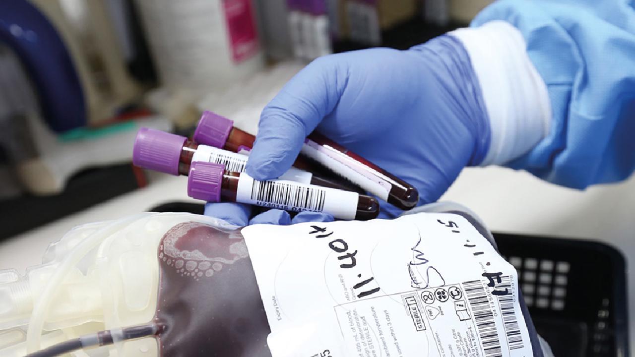 Diferencias entre suero y plasma