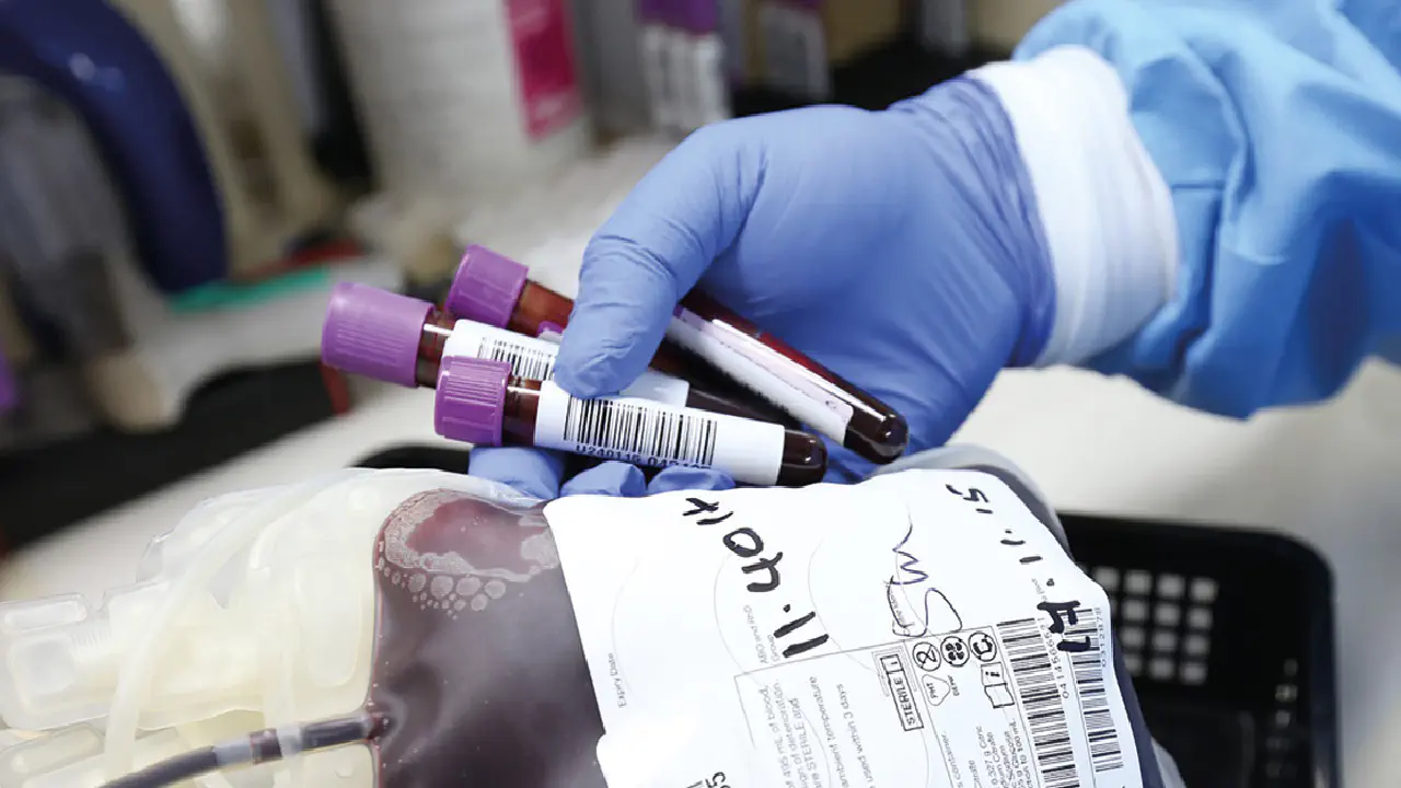 Diferencias entre suero y plasma